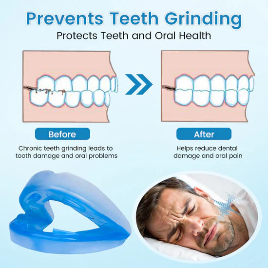 LAST DAY SALE 60% OFF ⏰ AirSleepPro™ Anti-Snoring & Teeth Grinding Solution