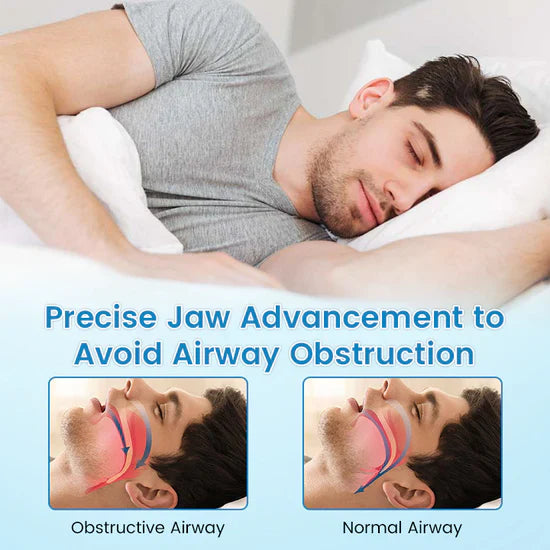 LAST DAY SALE 60% OFF ⏰ AirSleepPro™ Anti-Snoring & Teeth Grinding Solution