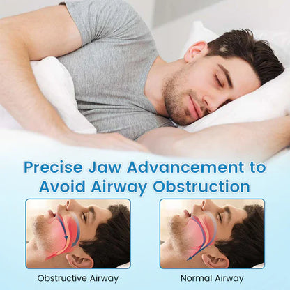 LAST DAY SALE 60% OFF ⏰ AirSleepPro™ Anti-Snoring & Teeth Grinding Solution